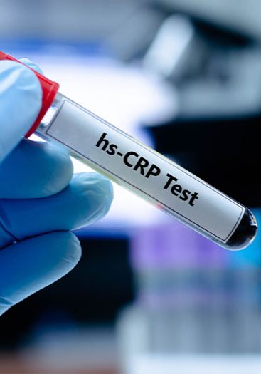 Dashboard_835_crp_test_06_24